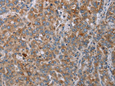 REG3A Antibody