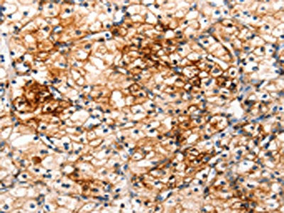 IRAK2 Antibody