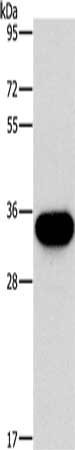 HOXB13 Antibody