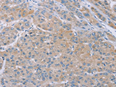 SAMD4B Antibody