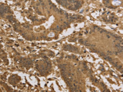 KDM5B Antibody