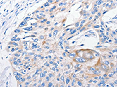 FANCF Antibody