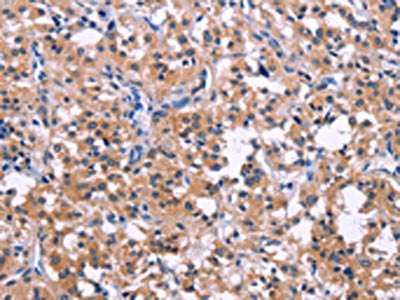 DUSP13 Antibody