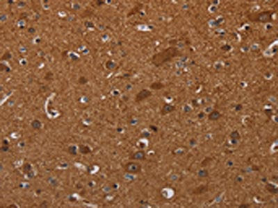 CYBB Antibody