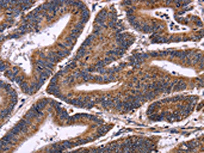 AMIGO2 Antibody