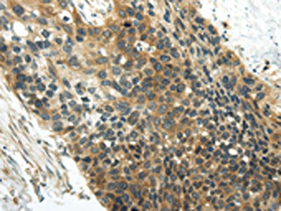 WISP1 Antibody