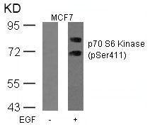 Phospho-RPS6KB1 (Ser411) Antibody