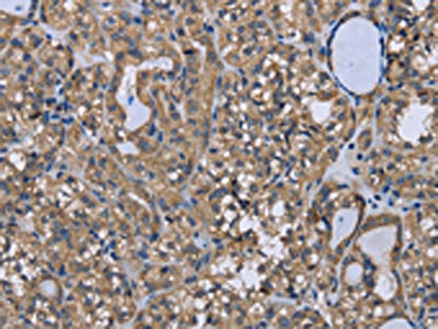 FOXO1 Antibody