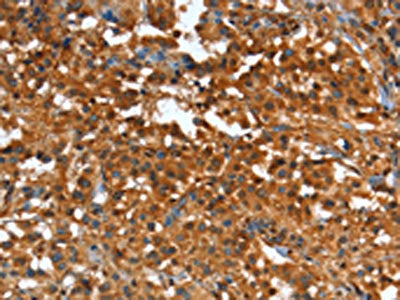 CR1 Antibody