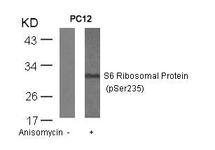 Phospho-RPS6 (Ser235) Antibody