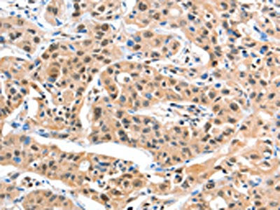 DDX4 Antibody