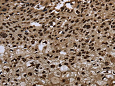 ANP32E Antibody
