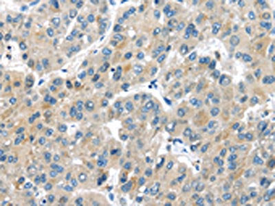 MASP2 Antibody