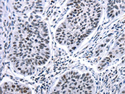 HSPB2 Antibody