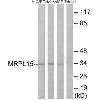 MRPL15 Antibody