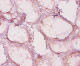 HDAC4 Antibody