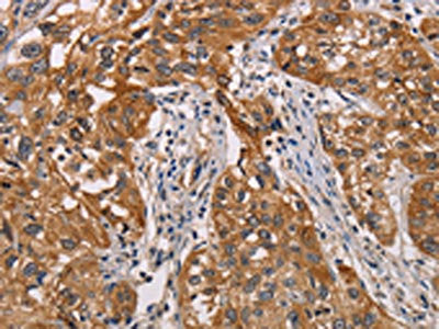 CRYAB Antibody