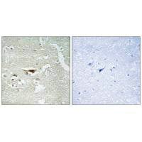 PKIB Antibody