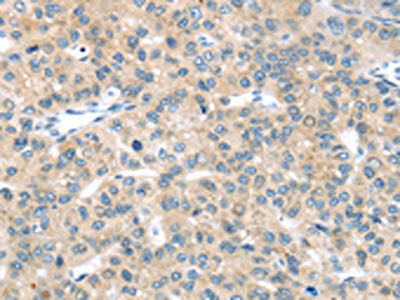 EPHA2 Antibody