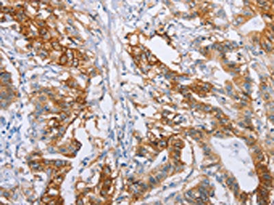 CA9 Antibody