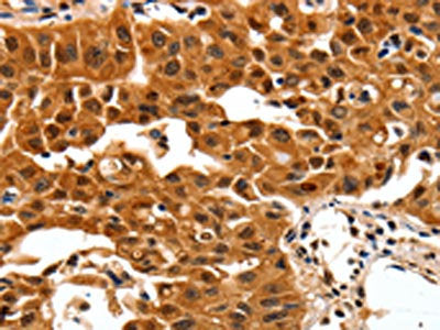 YWHAB Antibody