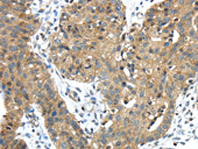 TMPRSS11E Antibody