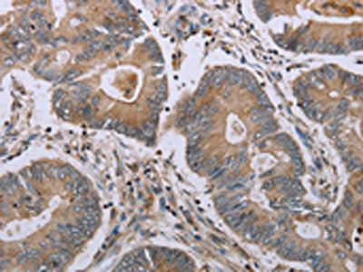 MAVS Antibody