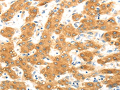 MAP2K6 Antibody