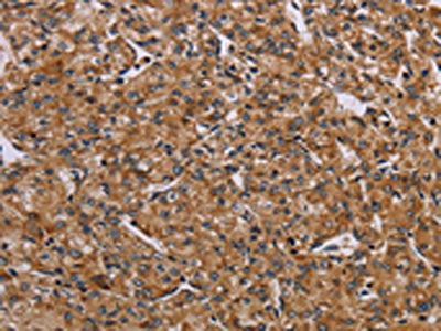 AATK Antibody