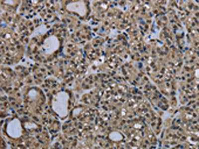 UBB Antibody