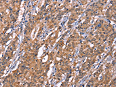 HRASLS2 Antibody