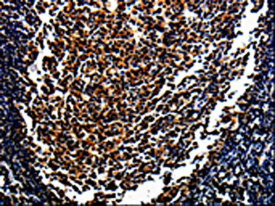 MAGEA4 Antibody