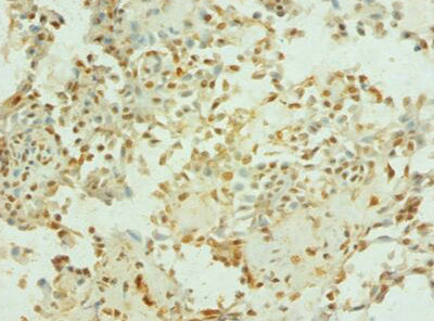 TEP1 Antibody