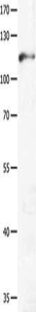 GRM3 Antibody