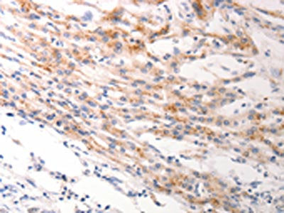 KRT6A/KRT6B/KRT6C Antibody