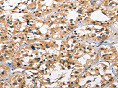 GPR182 Antibody