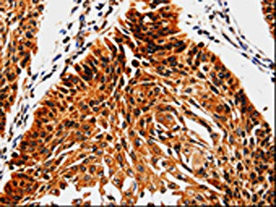 ABCB5 Antibody