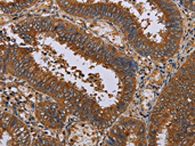 NPTX1 Antibody