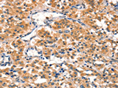 AIMP1 Antibody