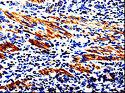ACSBG2 Antibody