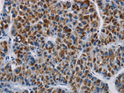 SAR1B Antibody