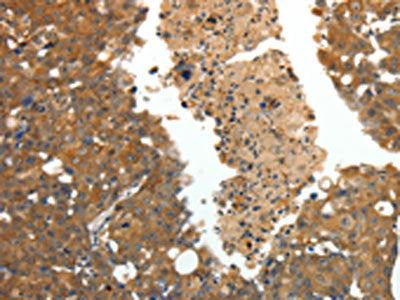 CRP Antibody