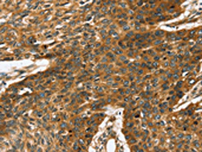 TRPV5 Antibody