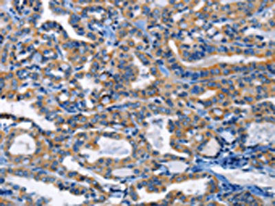 HCK Antibody