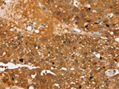 TBC1D4 Antibody