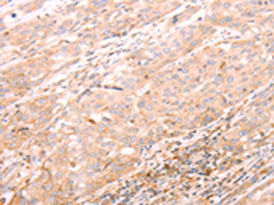 ALPPL2 Antibody