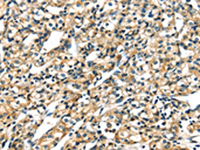 KRT17 Antibody