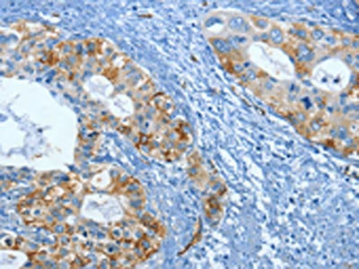 FSCN1 Antibody