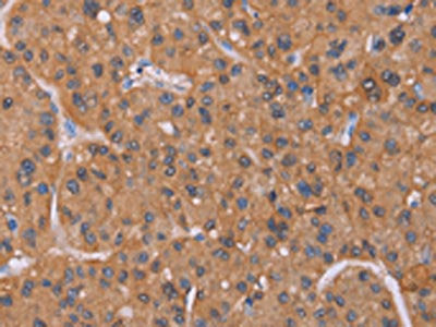 CALCA Antibody