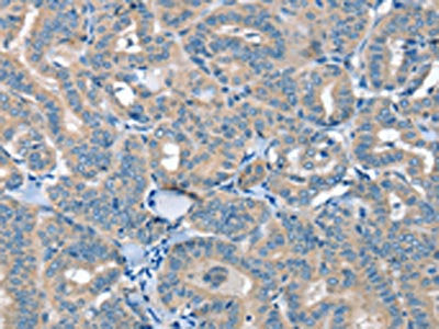 SEPN1 Antibody